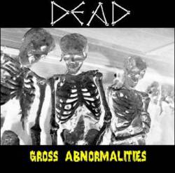 Dead (USA) : Gross Abnormalities